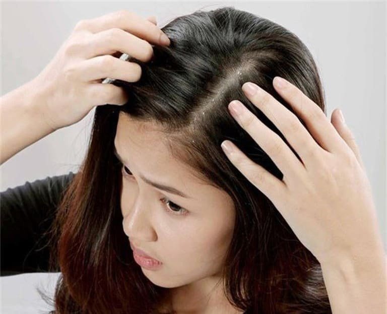 Trứng tóc là một trong những hiện tượng khá thường thấy ở các chị em phụ nữ - Ảnh 3