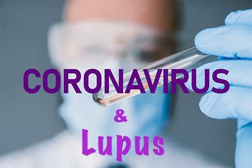 Mối liên hệ giữa covid19 và Lupus ban đỏ - Ảnh 1