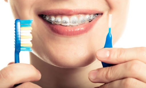 Vệ sinh răng miệng tốt cũng là cách giảm đau khi niềng răng - Ảnh 4