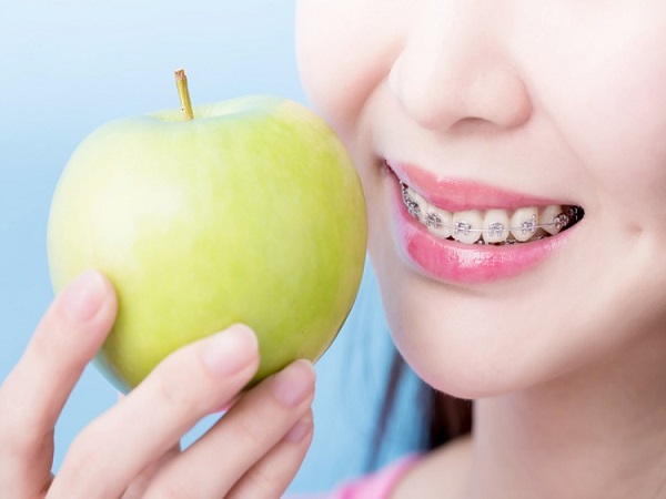 Tại sao cần tránh một số loại thực phẩm khi niềng răng - Ảnh 1