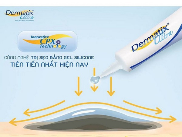 Cách phân biệt thuốc trị sẹo Dermatix Ultra hàng giả thật - Ảnh 6