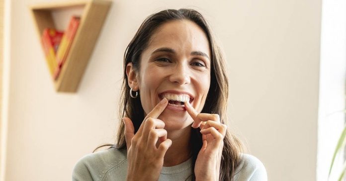 Những điều bạn cần biết trước khi niềng răng hàm trên