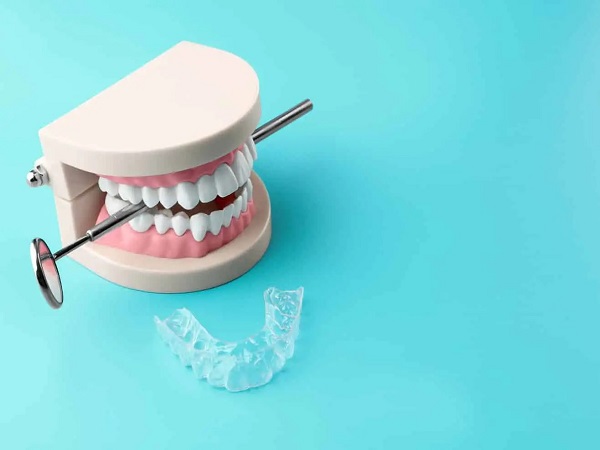 Phương pháp niềng răng bạn lựa chọn - Ảnh 4