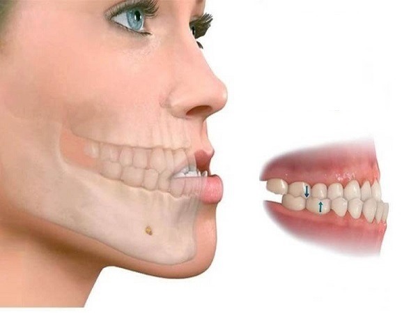 Tình trạng răng ở người lớn - Ảnh 2