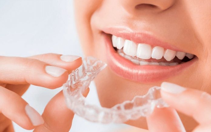 Chăm sóc răng miệng của bạn khi niềng răng trong suốt | VNCARE