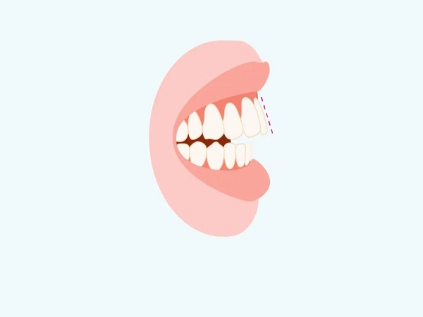 Kiểm tra tình trạng răng miệng - Ảnh 2