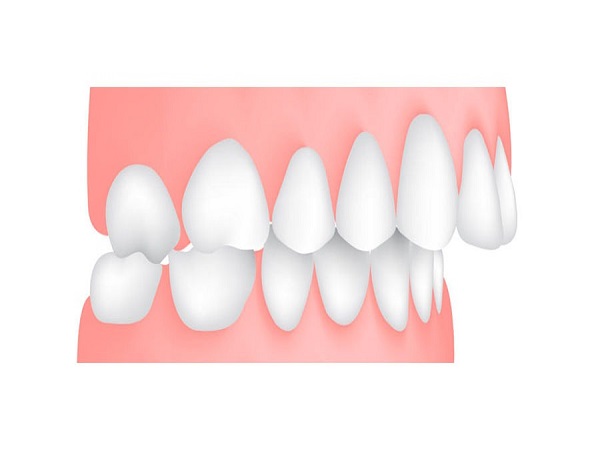 Tình trạng sức khỏe của răng miệng - Ảnh 3