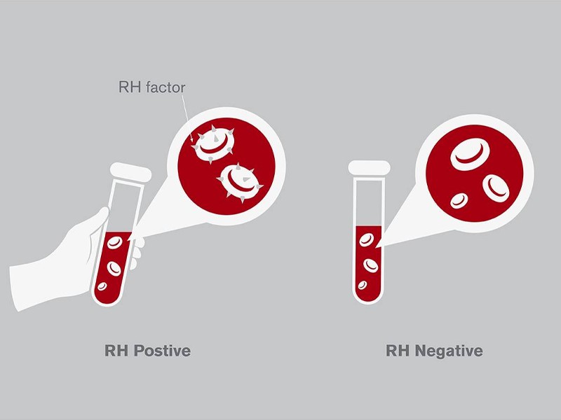 Xét nghiệm nhóm máu Rh là điều cần thiết khi mang thai