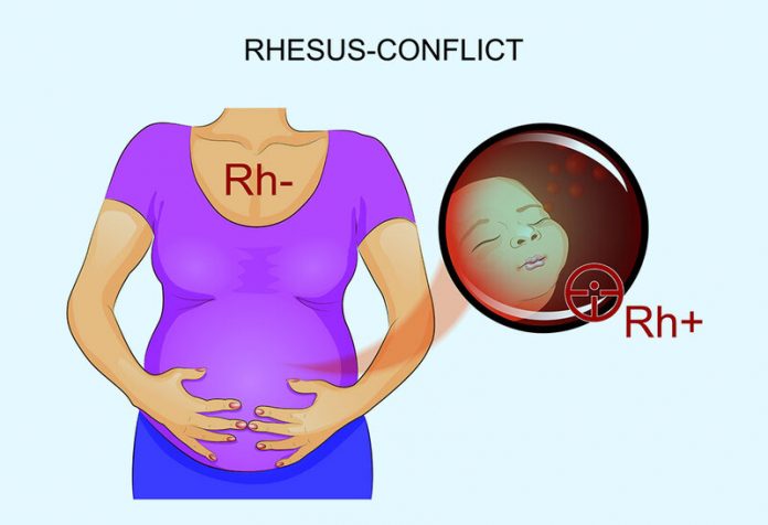 Mẹ bầu có nhóm máu Rh: Những thông tin quan trọng cần biết