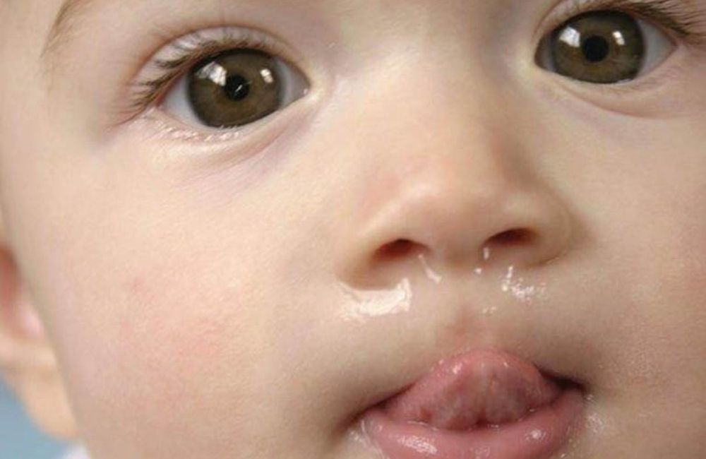 Nguyên nhân và cách trị sổ mũi ở trẻ sơ sinh