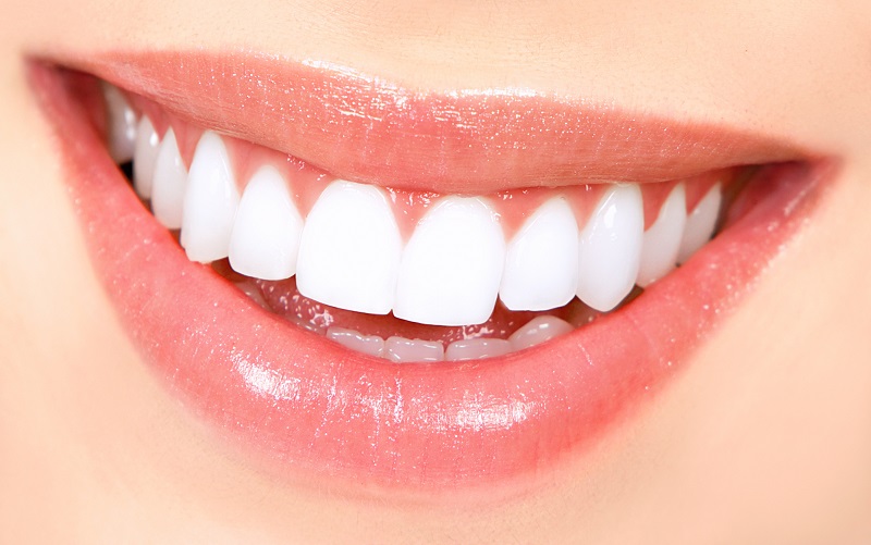 lợi ích khi răng đẹp