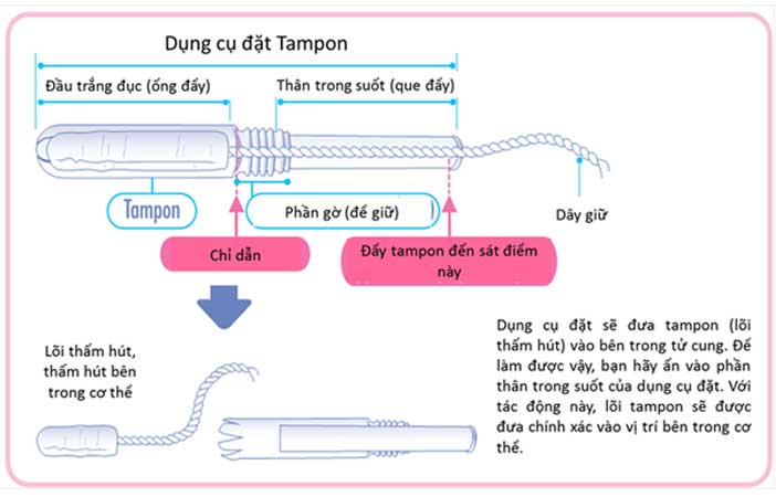 Tổng quan chi tiết về băng vệ sinh tampon và hướng dẫn sử dụng 
