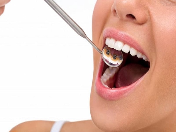 Giải pháp chăm sóc toàn diện sức khỏe răng miệng trẻ em