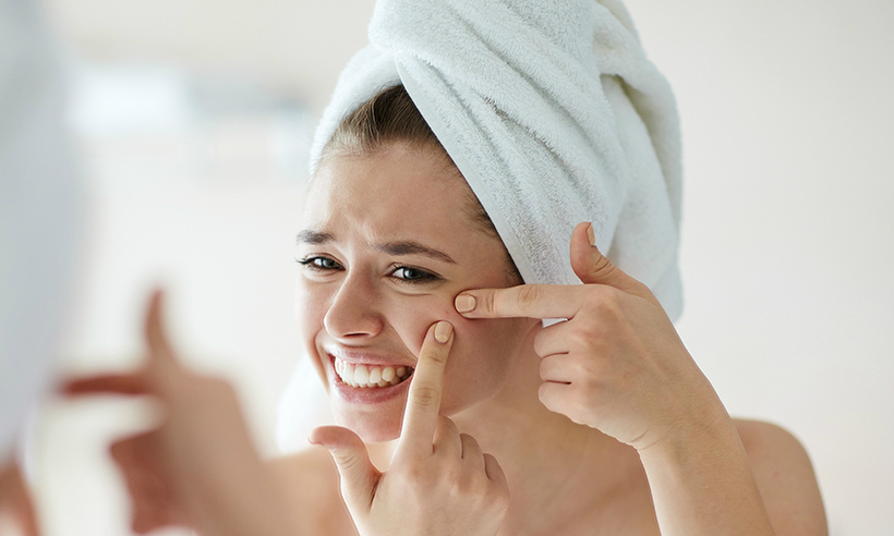 Vừa nặn mụn xong nên làm gì để tránh thâm sẹo
